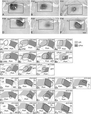 Understanding subcortical projections to the lateral posterior thalamic nucleus and its subregions using retrograde neural tracing